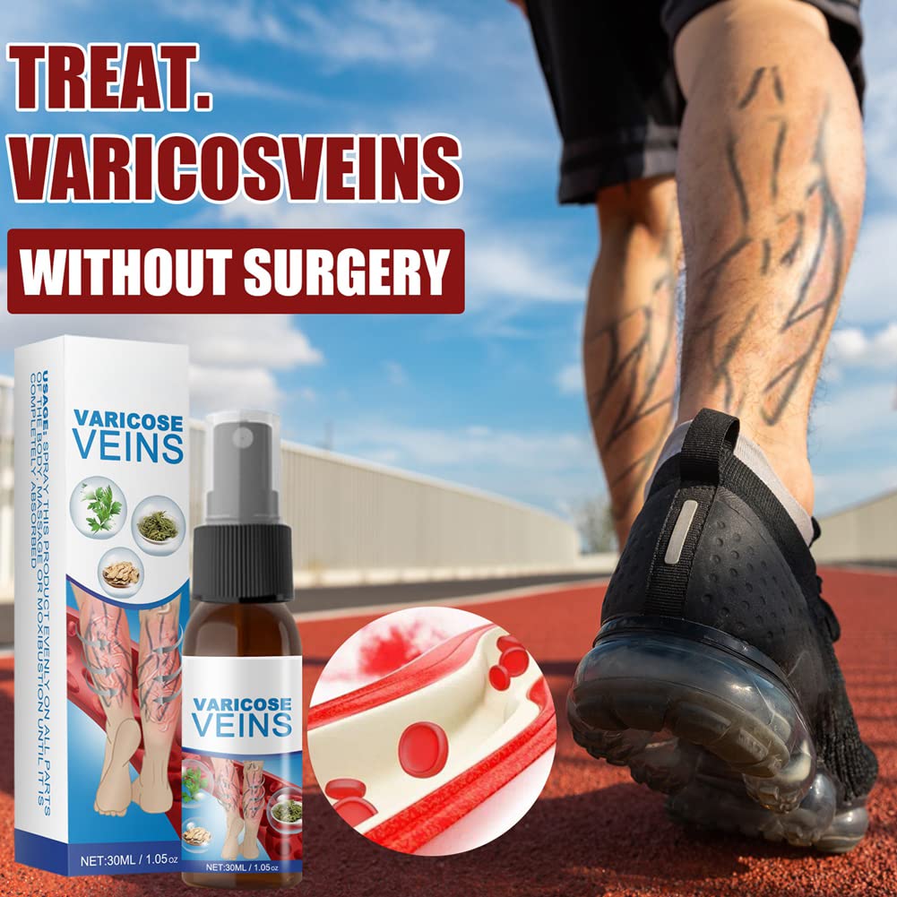 Varicose Veins Treatment Spray – Spider Veins, Leg Pain & Swelling Relief 30ml