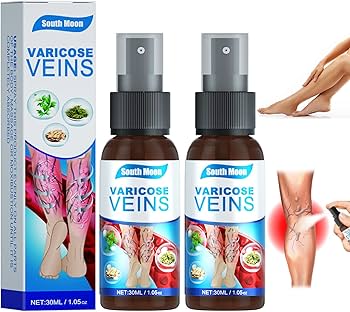 Varicose Veins Treatment Spray – Spider Veins, Leg Pain & Swelling Relief 30ml
